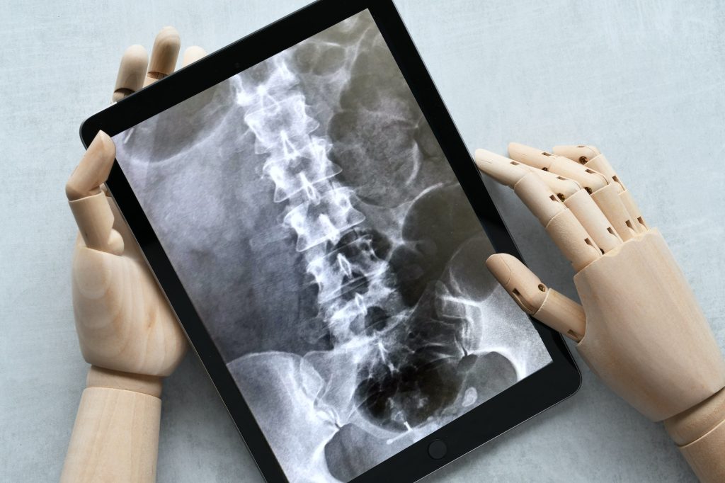 AI artificial intelligence medical diagnosis concept - robot hands holding a tablet with x-ray on t
